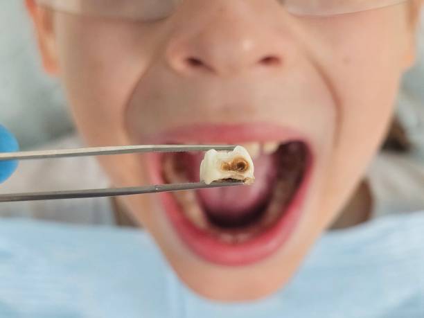 Best Pediatric Emergency Dentist in Grimes, IA